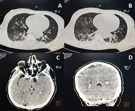 Fig 1