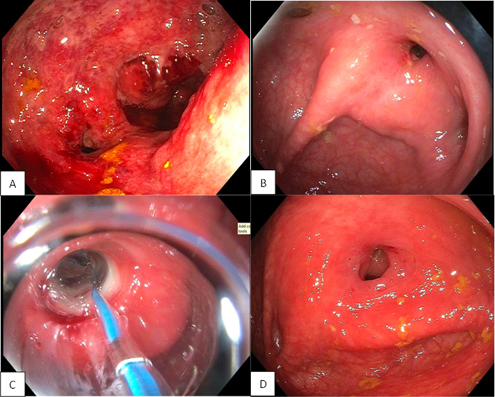 Fig 1