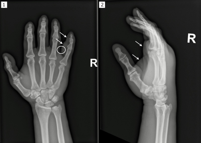 Fig 1
