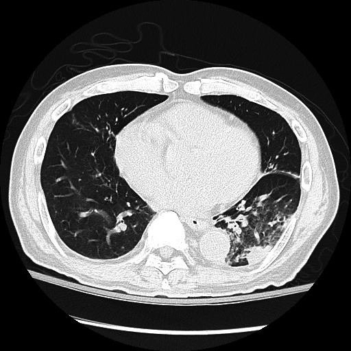 Fig 1