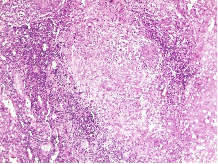 Fig 2