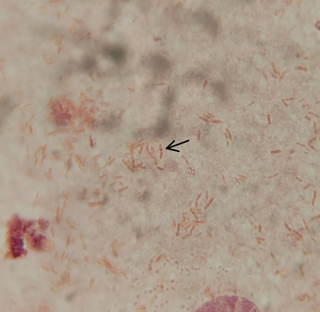 Fig 3