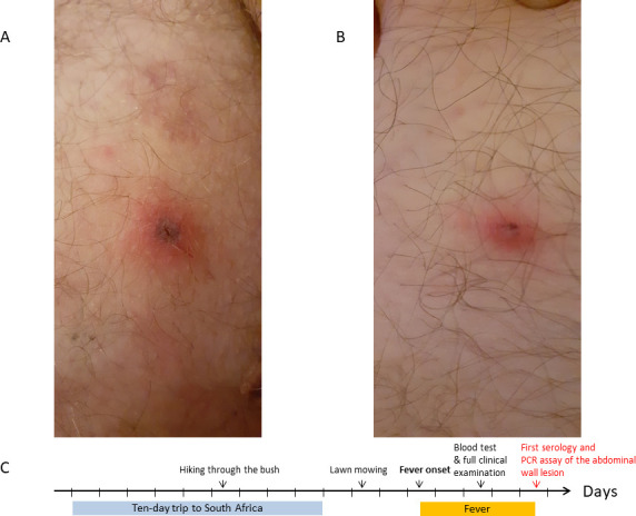 Fig 1