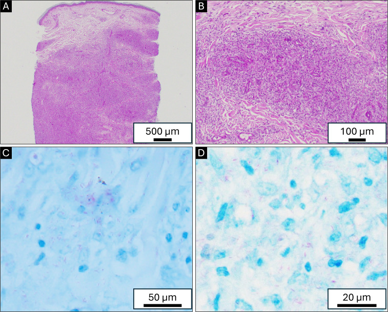 Fig 2