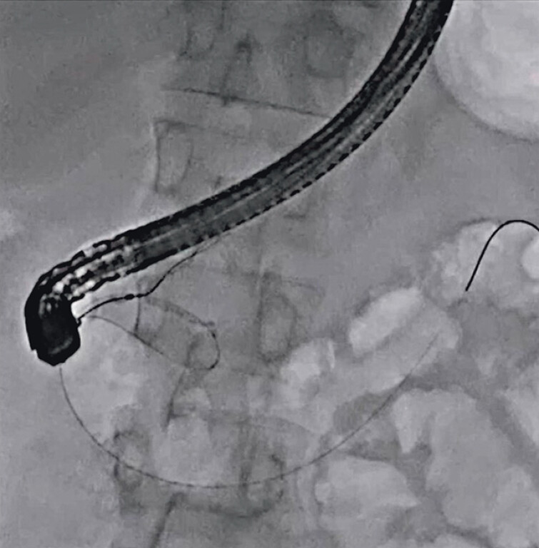 Fig. 2