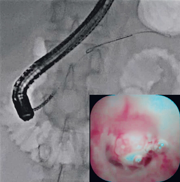 Fig. 3