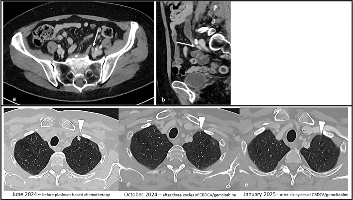 Figure 3