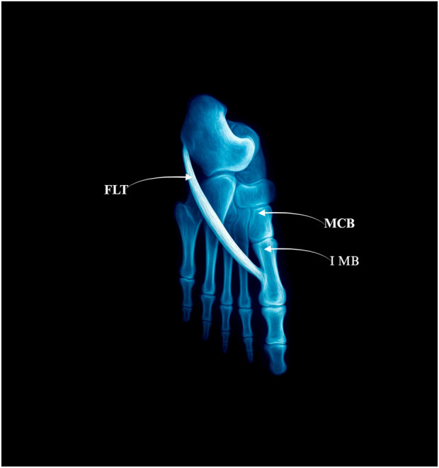 FIGURE 1