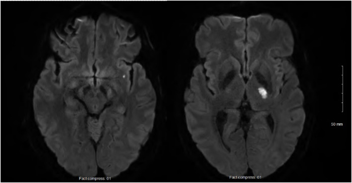 Figure 1