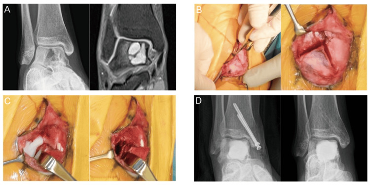Figure 4