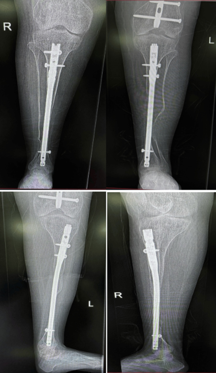 Figure 6