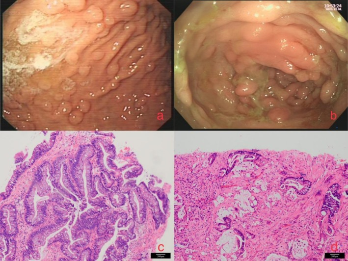 FIGURE 1