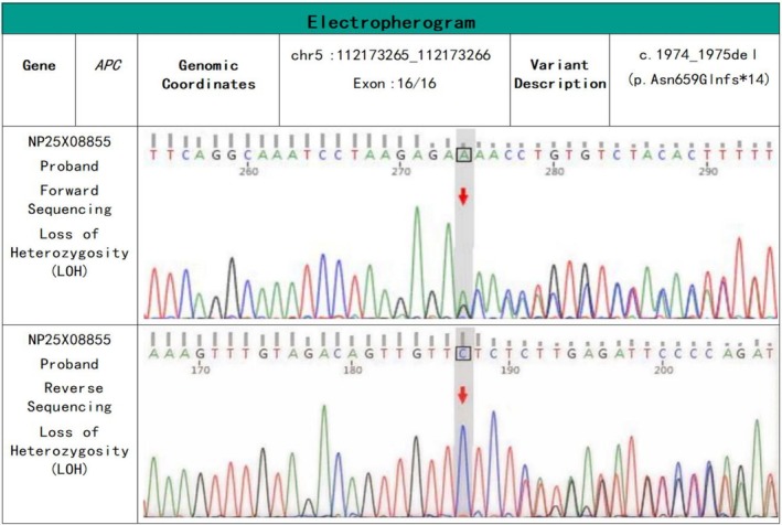 FIGURE 3
