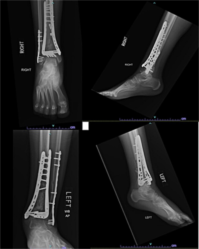 Figure 6