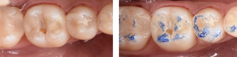 Fig 2a and b