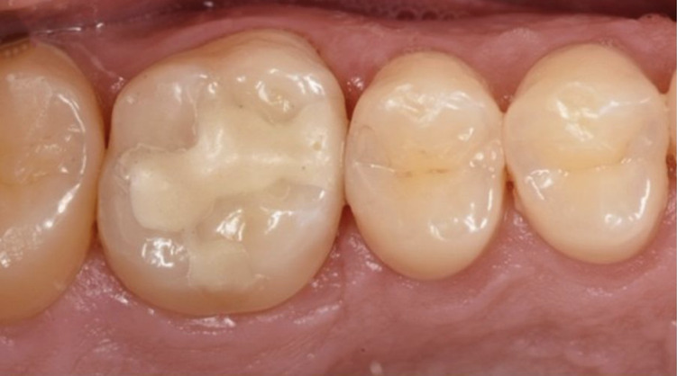 Fig 3
