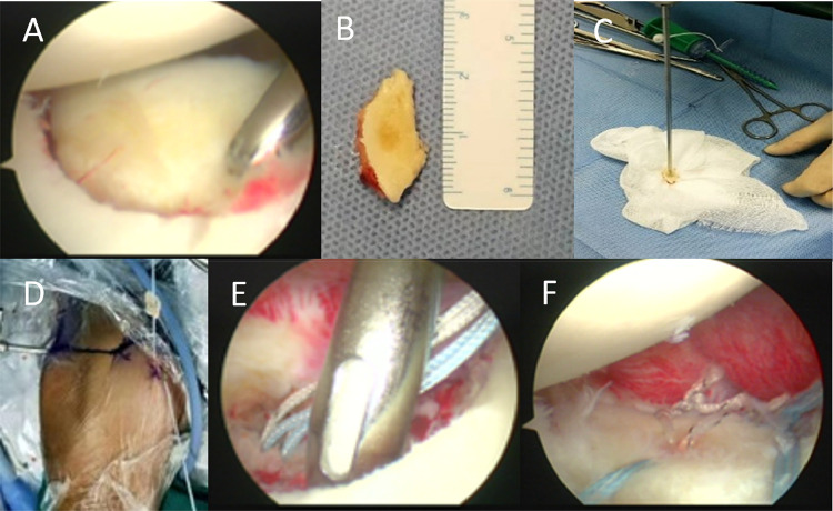 Figure 2