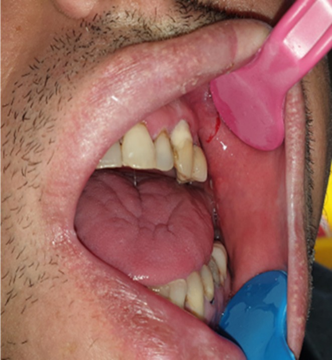 FIGURE 1