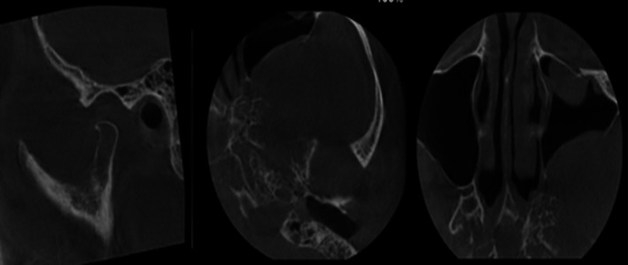 FIGURE 3