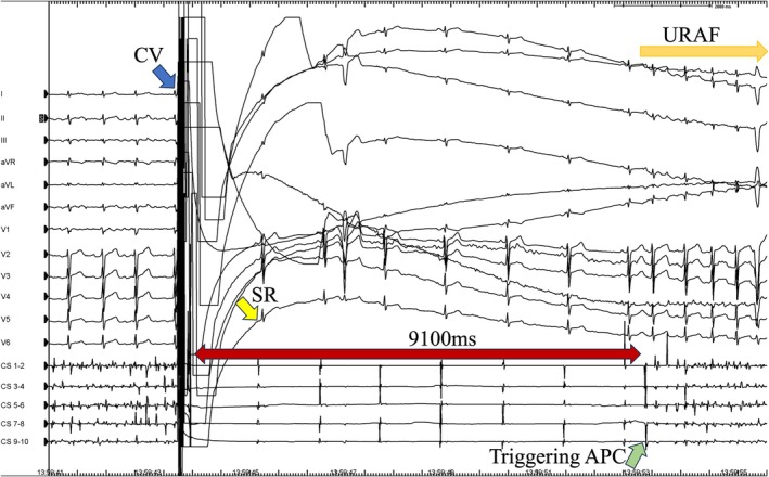 FIGURE 1