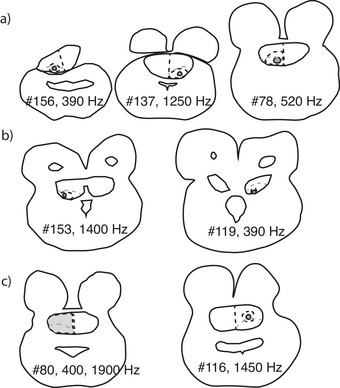 FIGURE 11