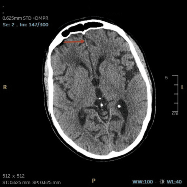 Figure 2