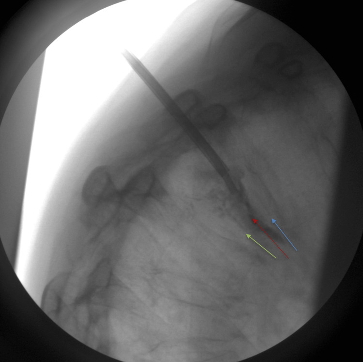 Figure 5