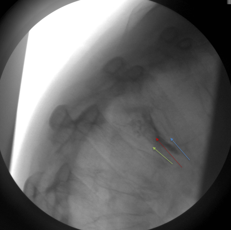 Figure 6