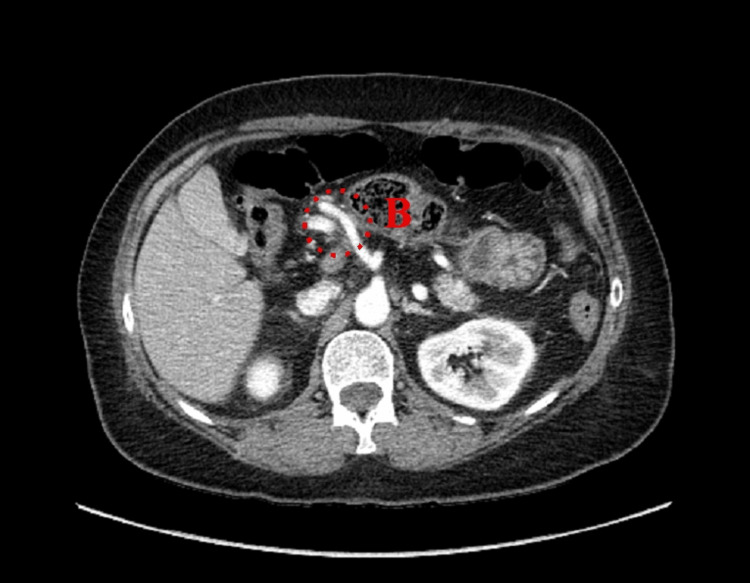 Figure 9