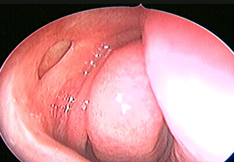 Figure 14