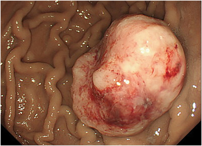 Fig. 1