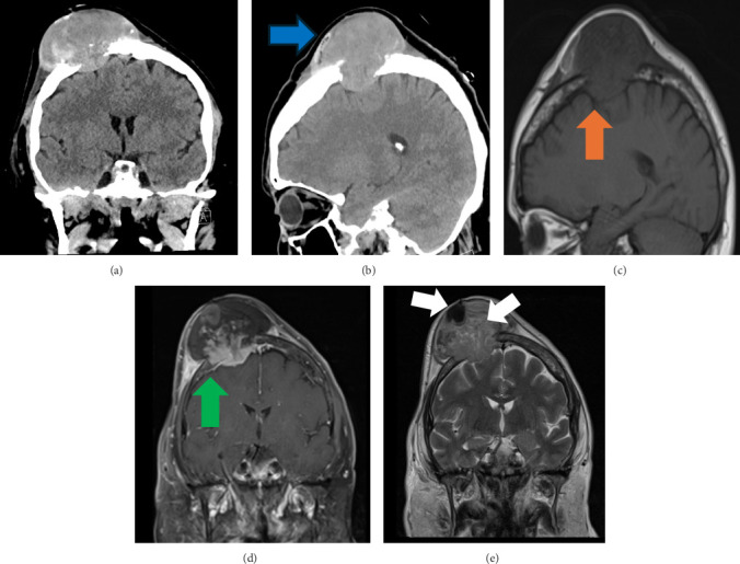Figure 2