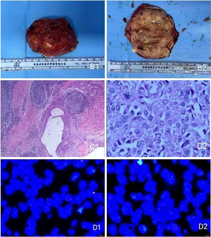 Figure 2