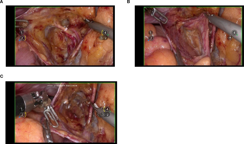 Figure 4