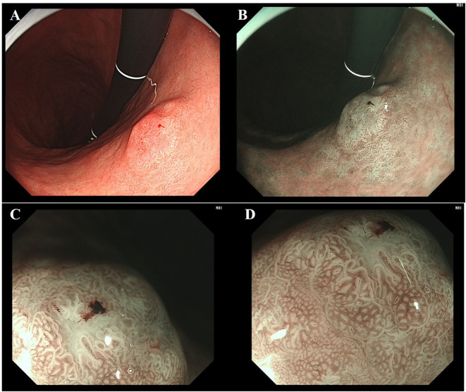 Figure 2