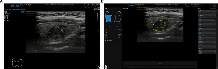 Figure 2