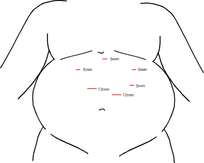 Fig. 2