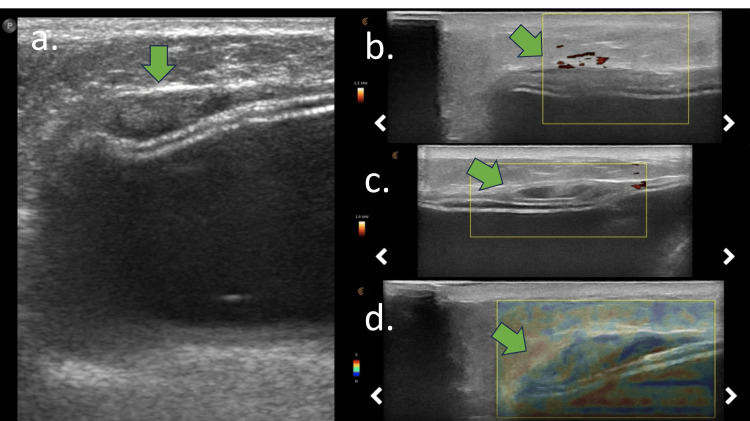Figure 6