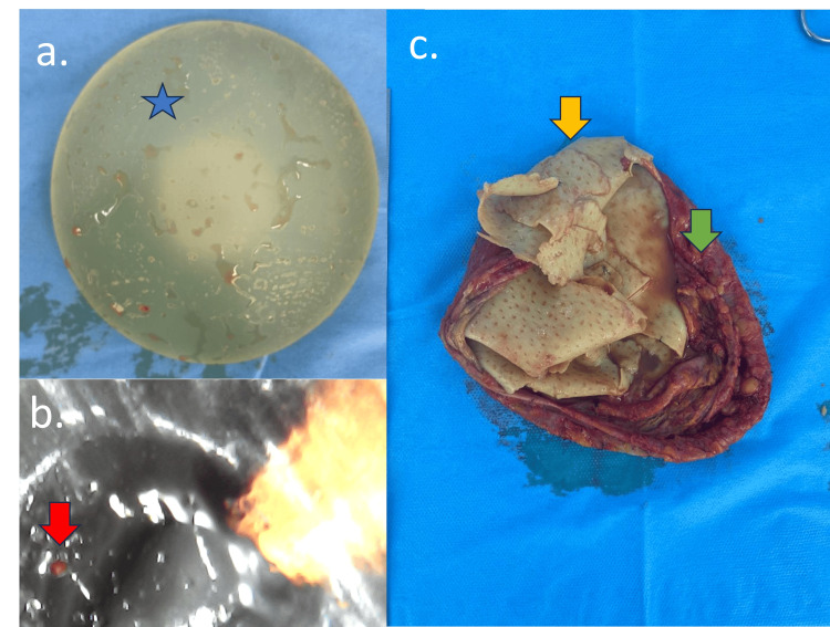 Figure 10