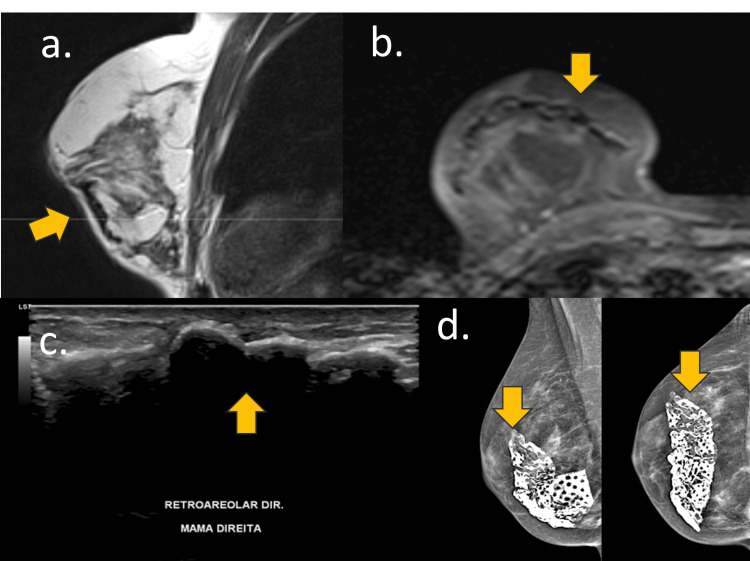 Figure 12
