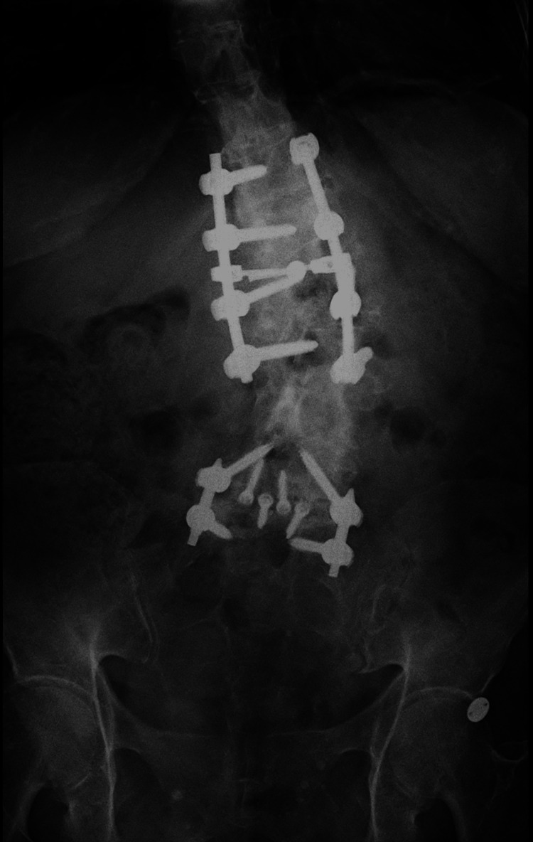 Figure 10