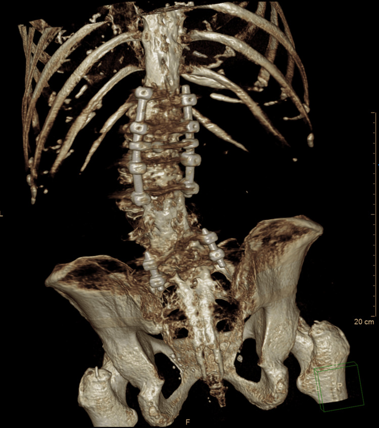 Figure 12