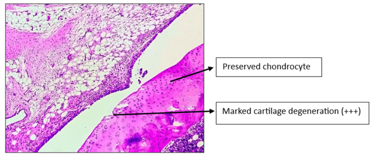 Figure 14