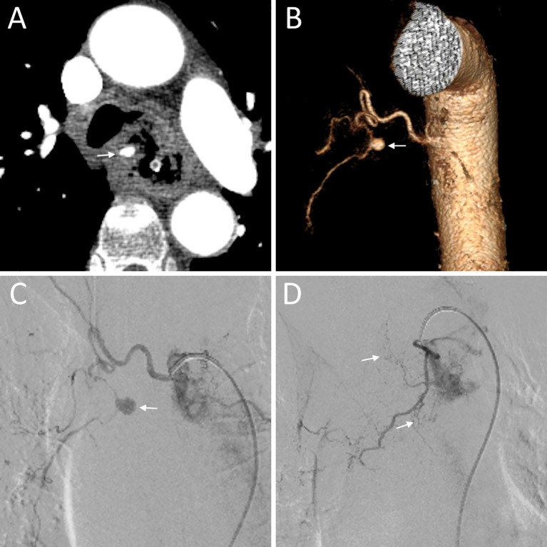Figure 2