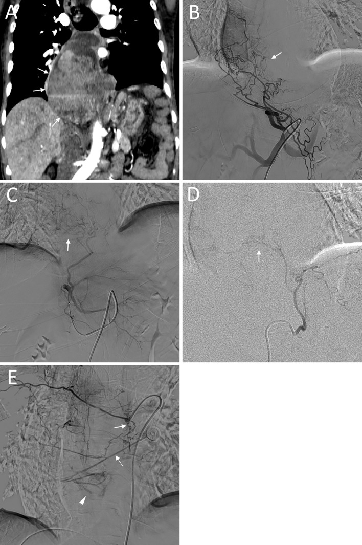 Figure 3