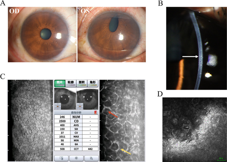 Figure 1