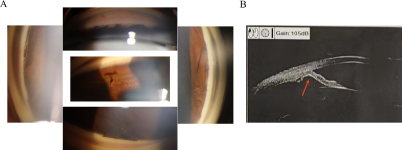 Figure 2