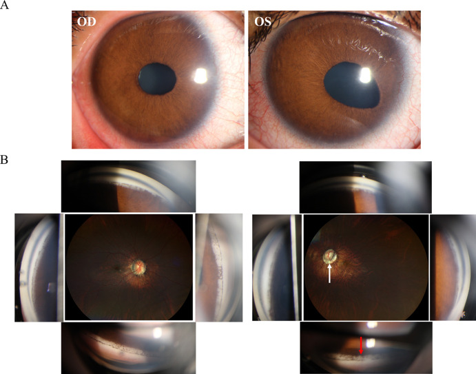 Figure 3