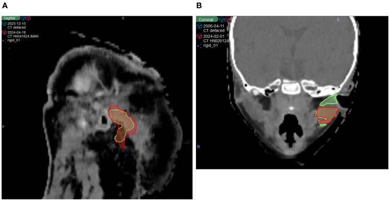 Figure 4