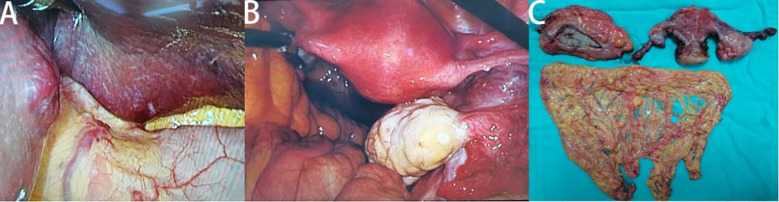 Figure 3